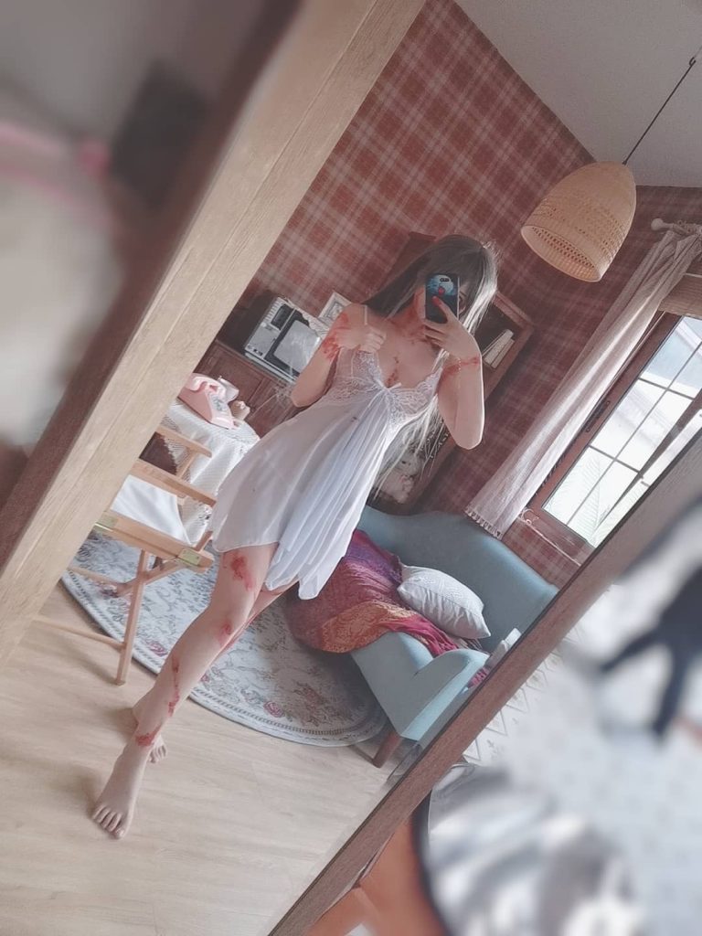 图片[1]_31P三度 受伤的希尔薇 cosplay福利NO.055_次元岛